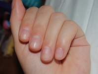 Kısa Tırnak Nasıl Uzatılır?